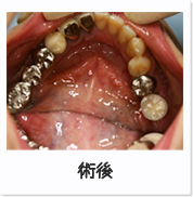 術後